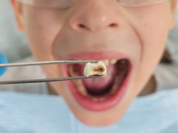 Best Cracked Tooth Emergency Dentist  in Noblesville, IN