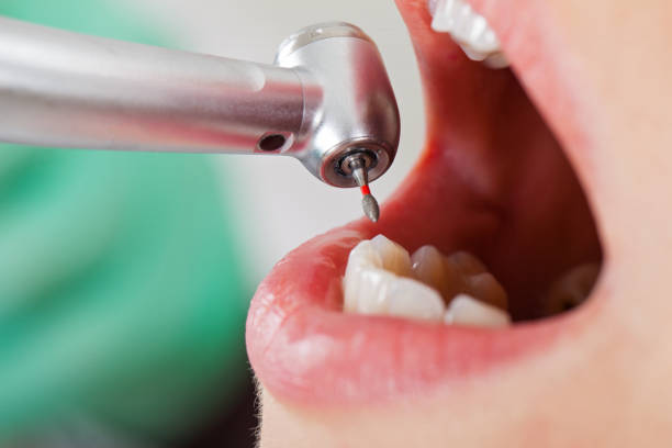 Best Broken Tooth Emergency  in Noblesville, IN